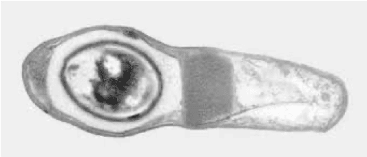Sporangia of Lysinibacillus sphaericus-img